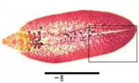 BỆNH SÁN LÁ GAN (Liver fluke disease)